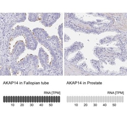 AKAP14 Antibody, Novus Biologicals 25 &mu;L, Unlabeled:Antibodies, Polyclonal